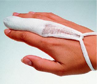 tg-Fingerlinge (50 Stck.)