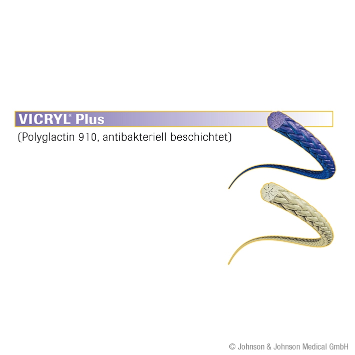 VICRYL Plus 2/0=3 violett geflochten Nahtmaterial Fadenlänge 3x45cm (36 Stck)