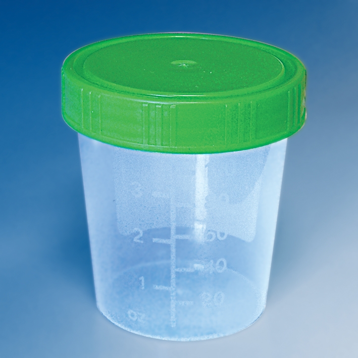 Urinbecher 100/125 ml mit Schraubdeckel grün