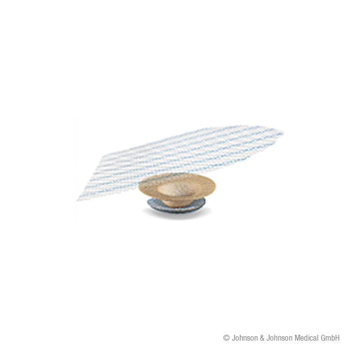 ULTRAPRO Plug groß MONOCRYL-PROLENE-Composite