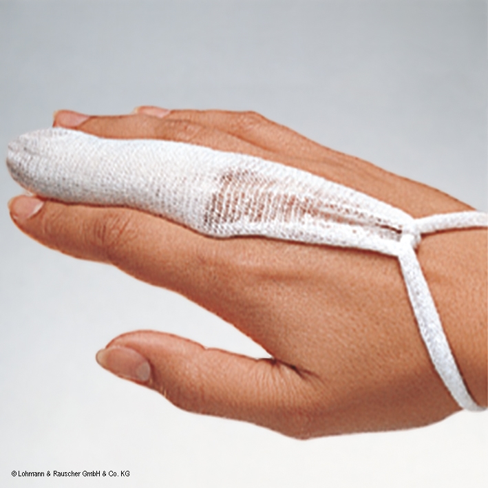 tg-Fingerlinge (50 Stck.)