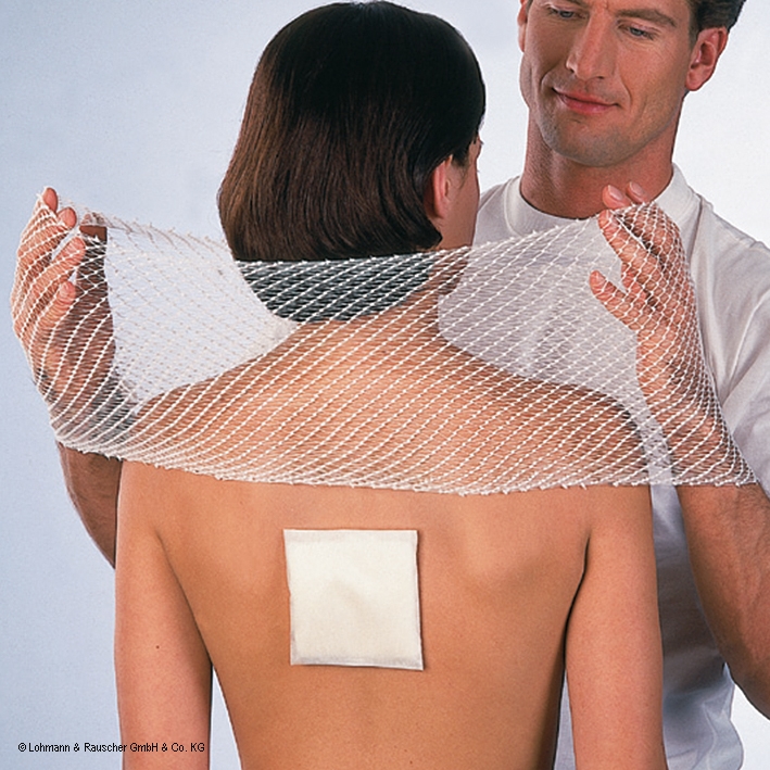 tg-fix Netzverband Gr. D, 25 m