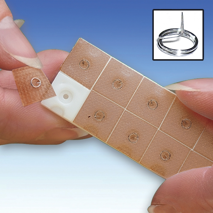 Ohr-Dauernadeln ratiomed 0,22 x 1,5 (10 x 10 Stck.)
